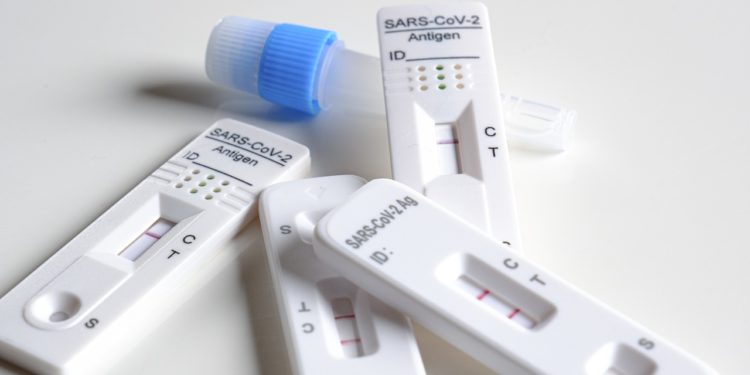 Na terenie województwa podkarpackiego darmowy test antygenowy w aptece można wykonać w 13 punktach